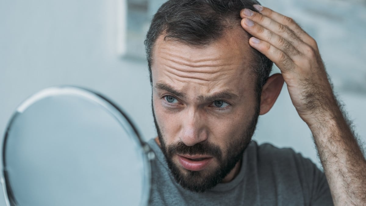 A man checking out hair loss in mirror