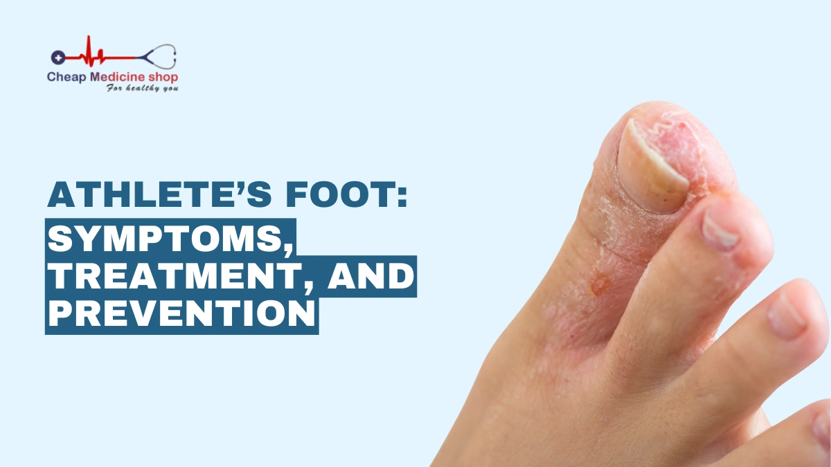 Athlete’s Foot