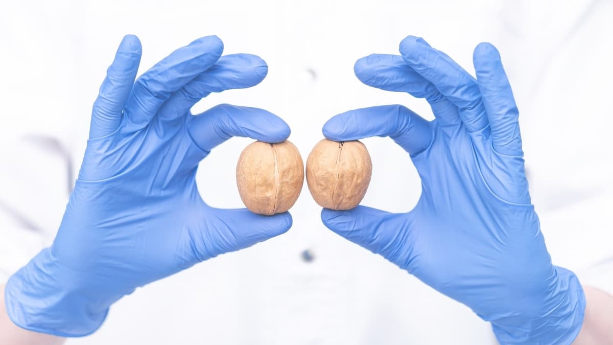 Doctor holding walnuts to represent testicles