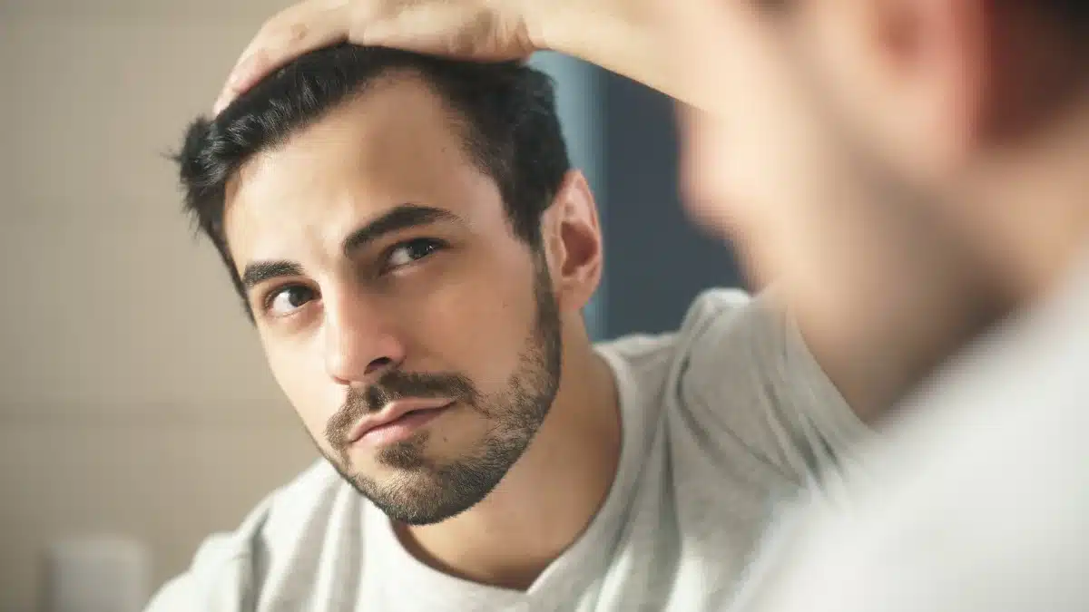 does testosterone cause hair loss