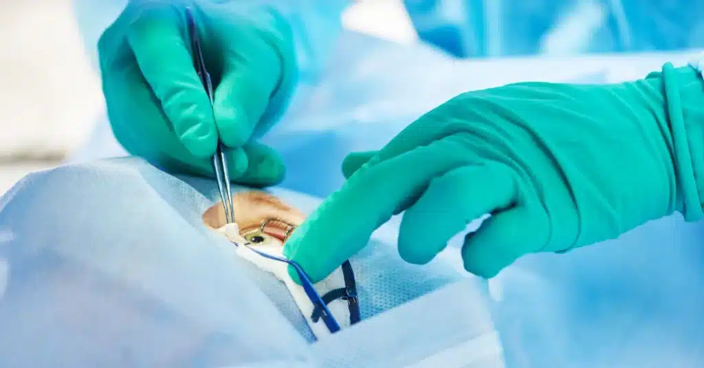 Eye Surgery