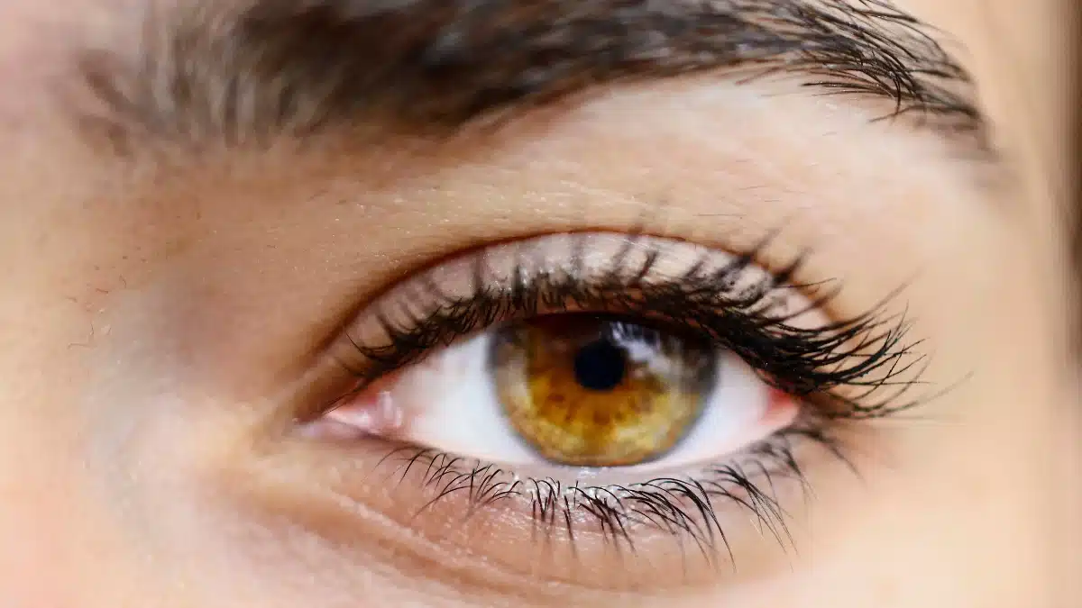 glaucoma natural treatment