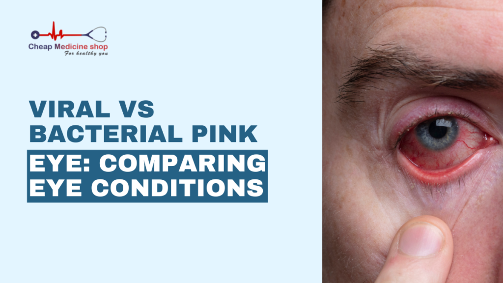 Viral vs Bacterial Pink Eye: How to Tell the Difference