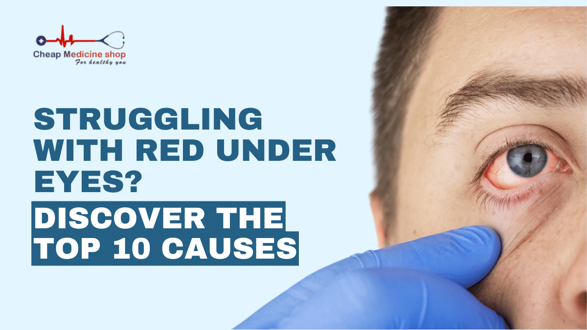 red undereye cause