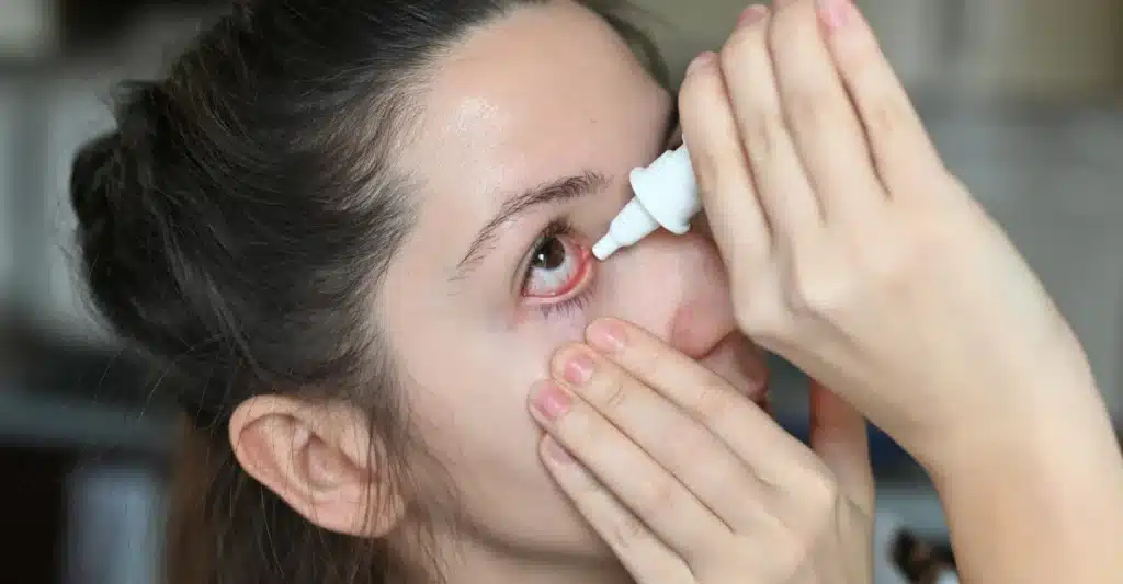 Eye infection treatment