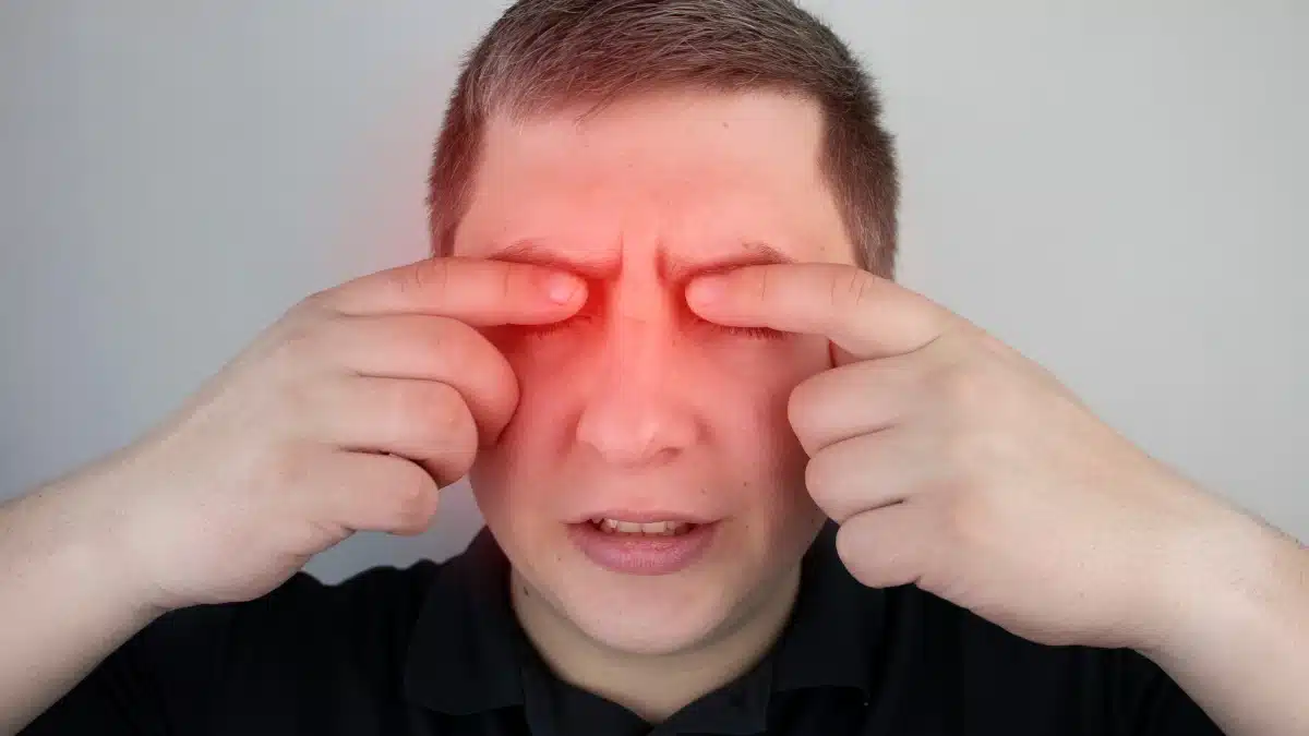 anterior uveitis