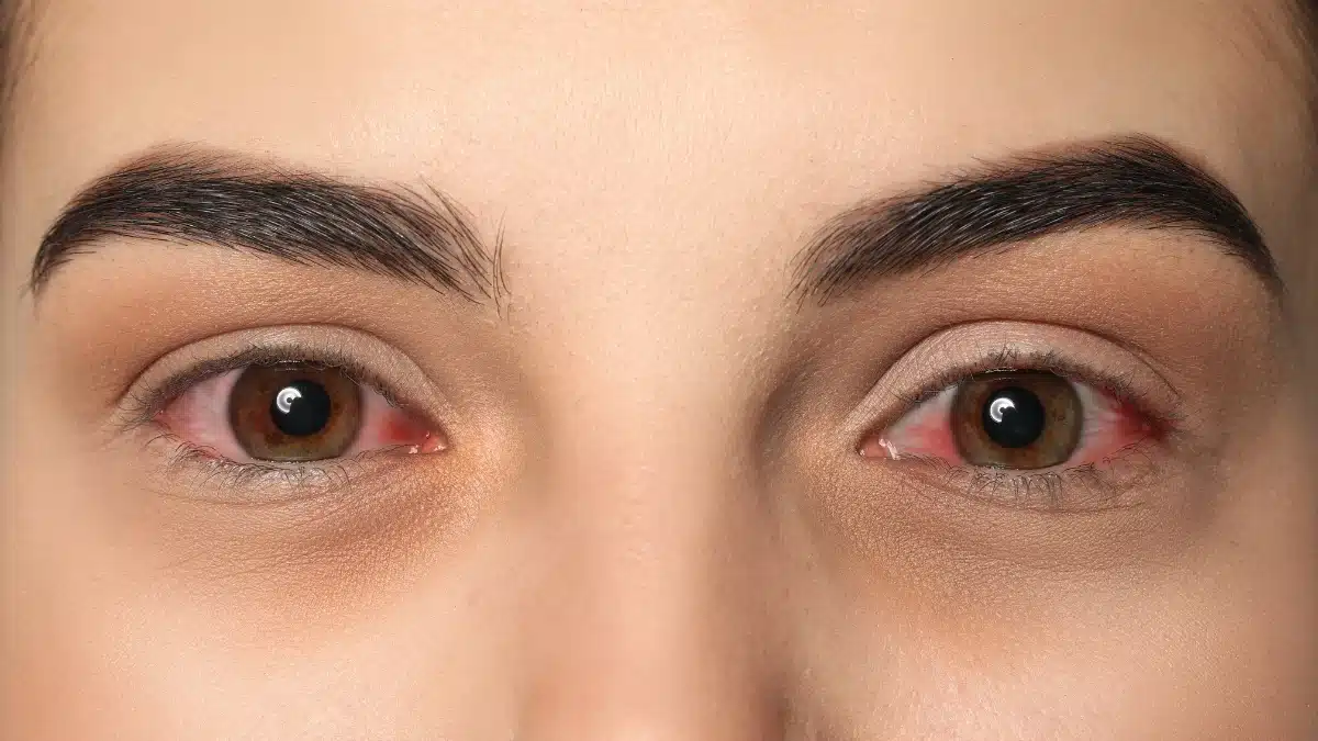can pink eye cause blindness