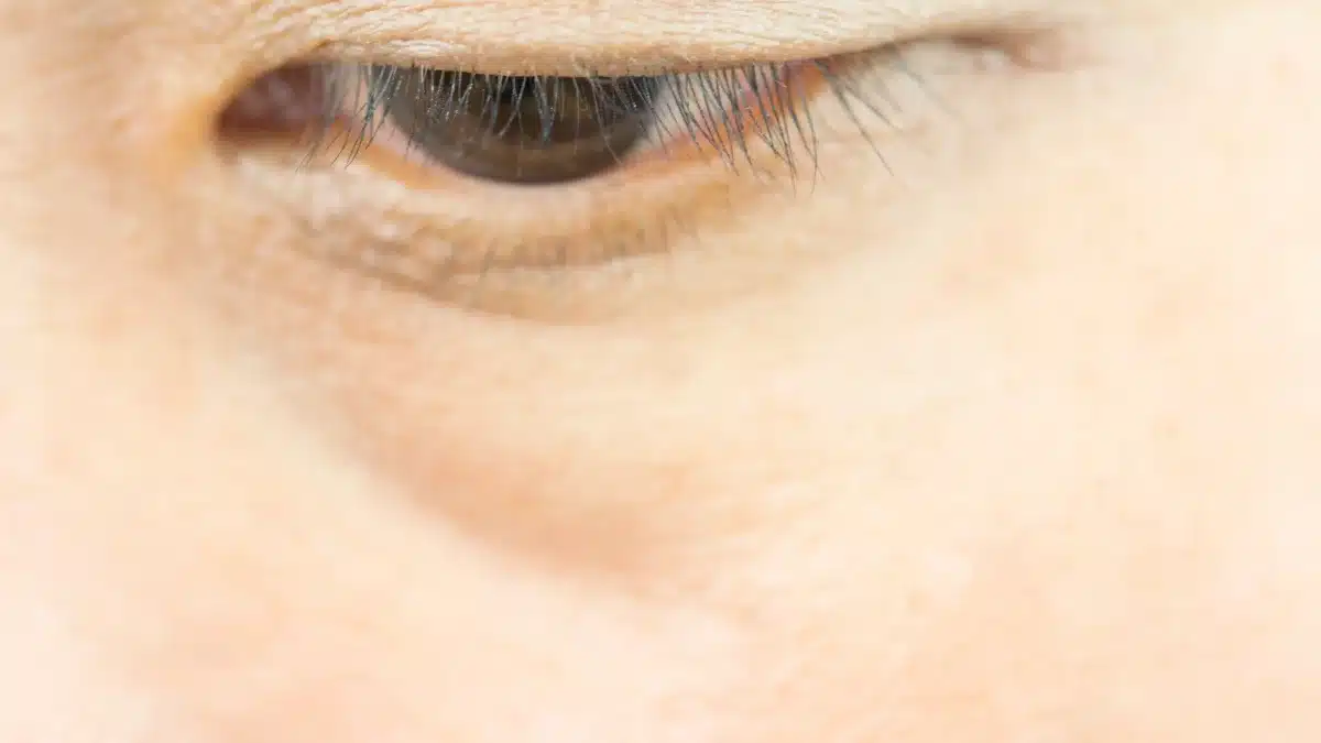best products for bags under eyes