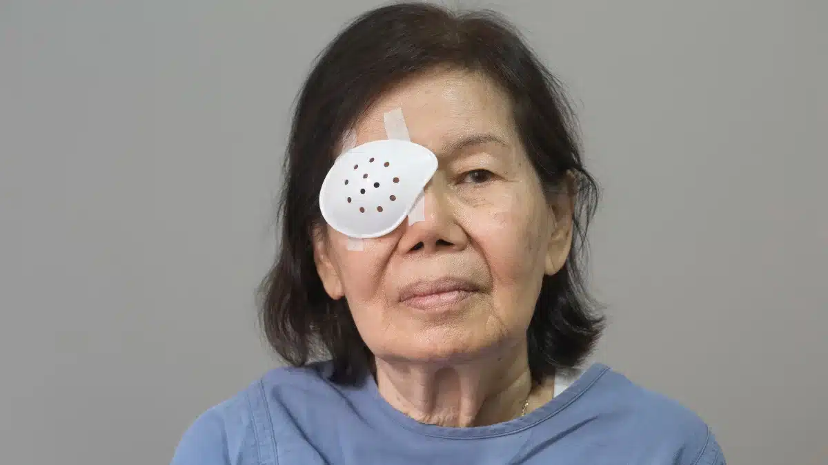 extracapsular cataract extraction