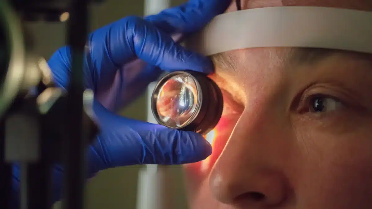intracapsular cataract extraction