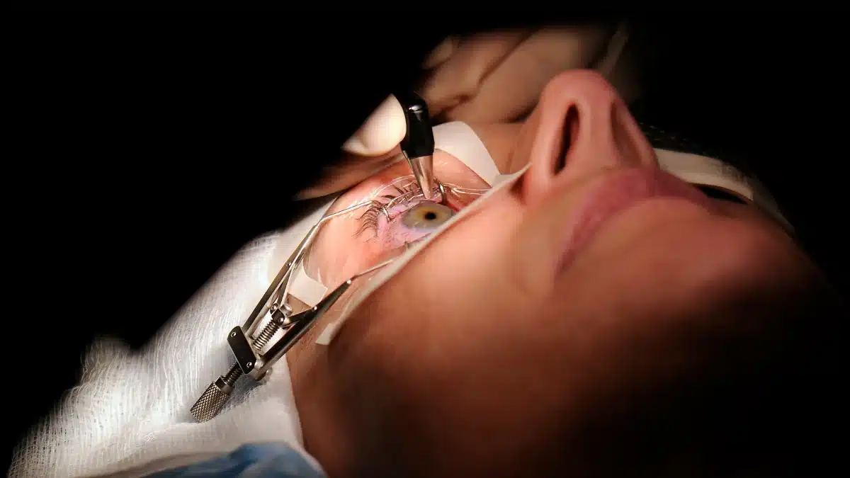 cataract surgery side effects
