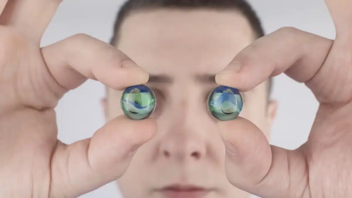 congenital cataracts