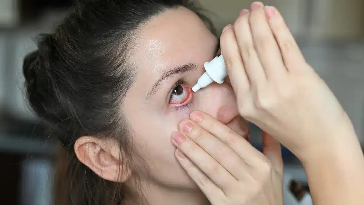 eye drops for watery eyes