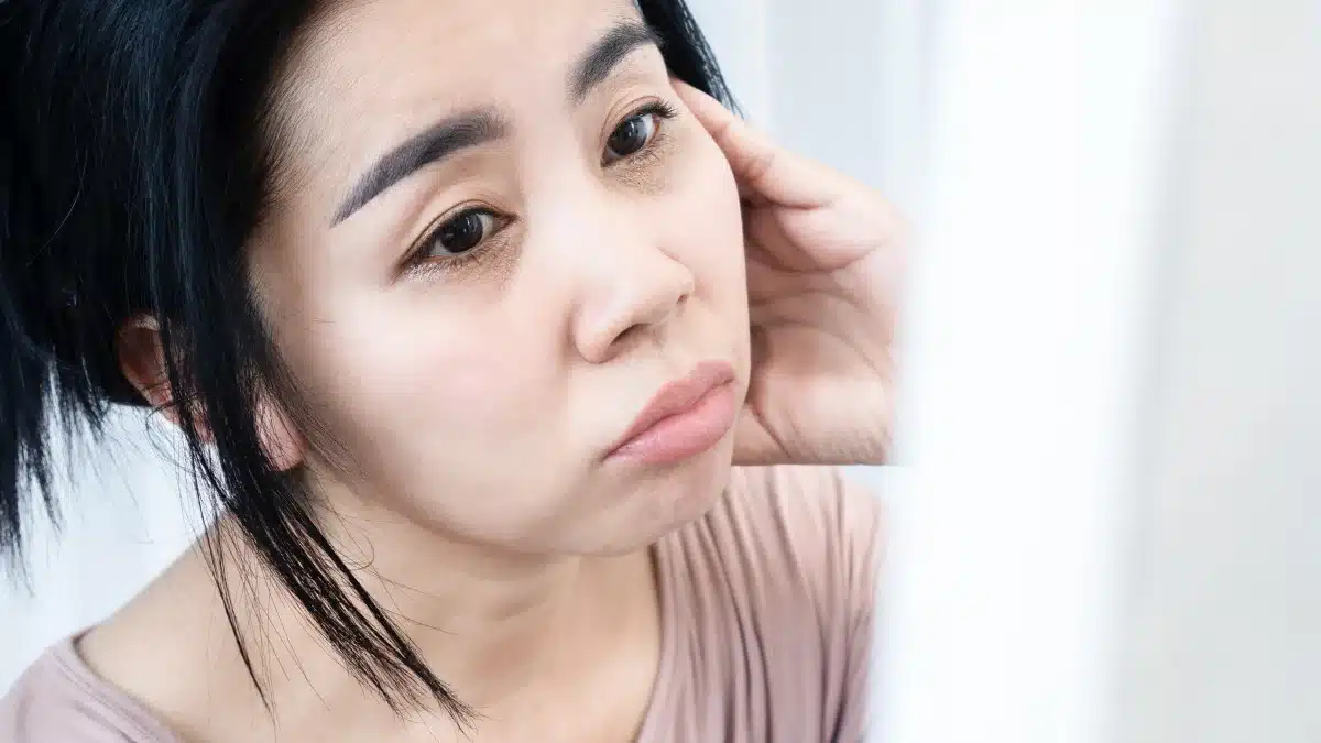 home remedies for dark circles