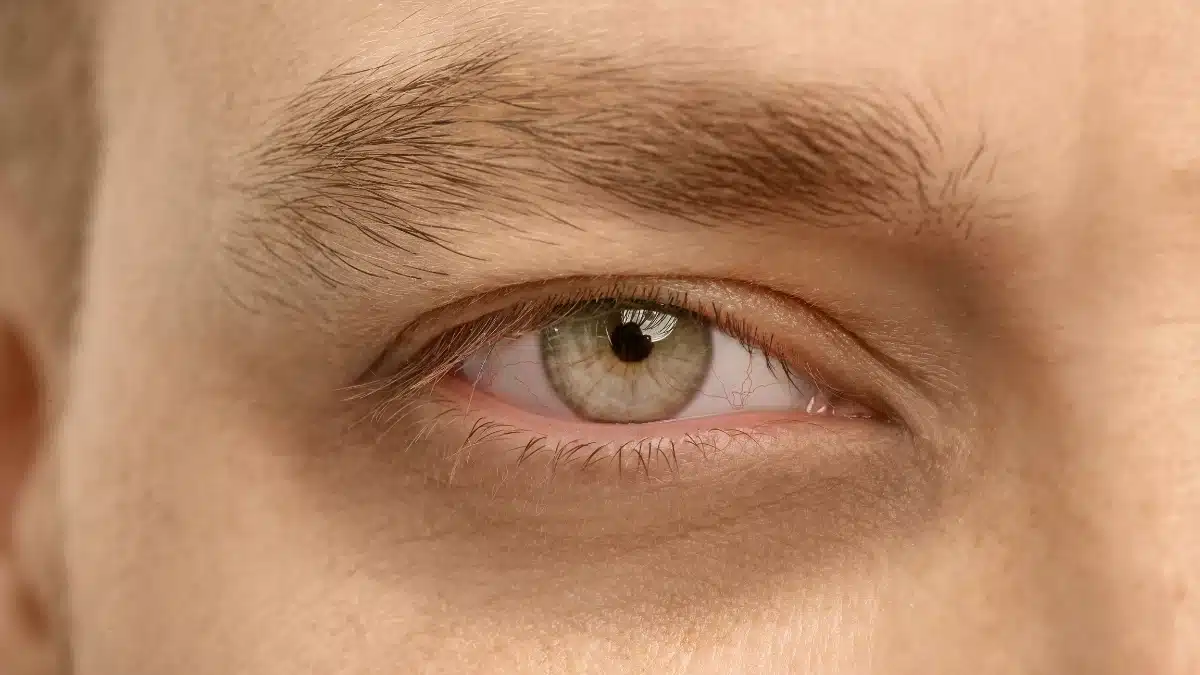 how to get rid of puffy eyes