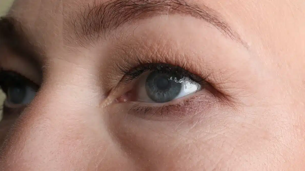 self test for cataracts
