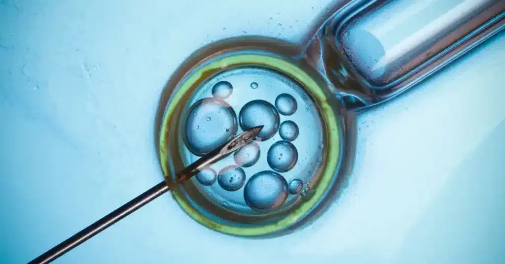 Microscopic research for IVF