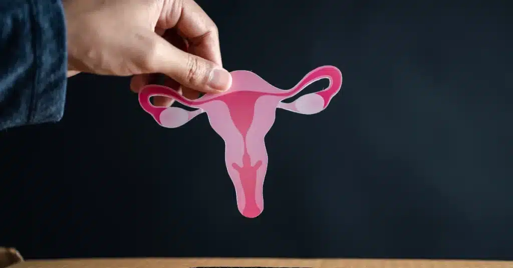 PCOS