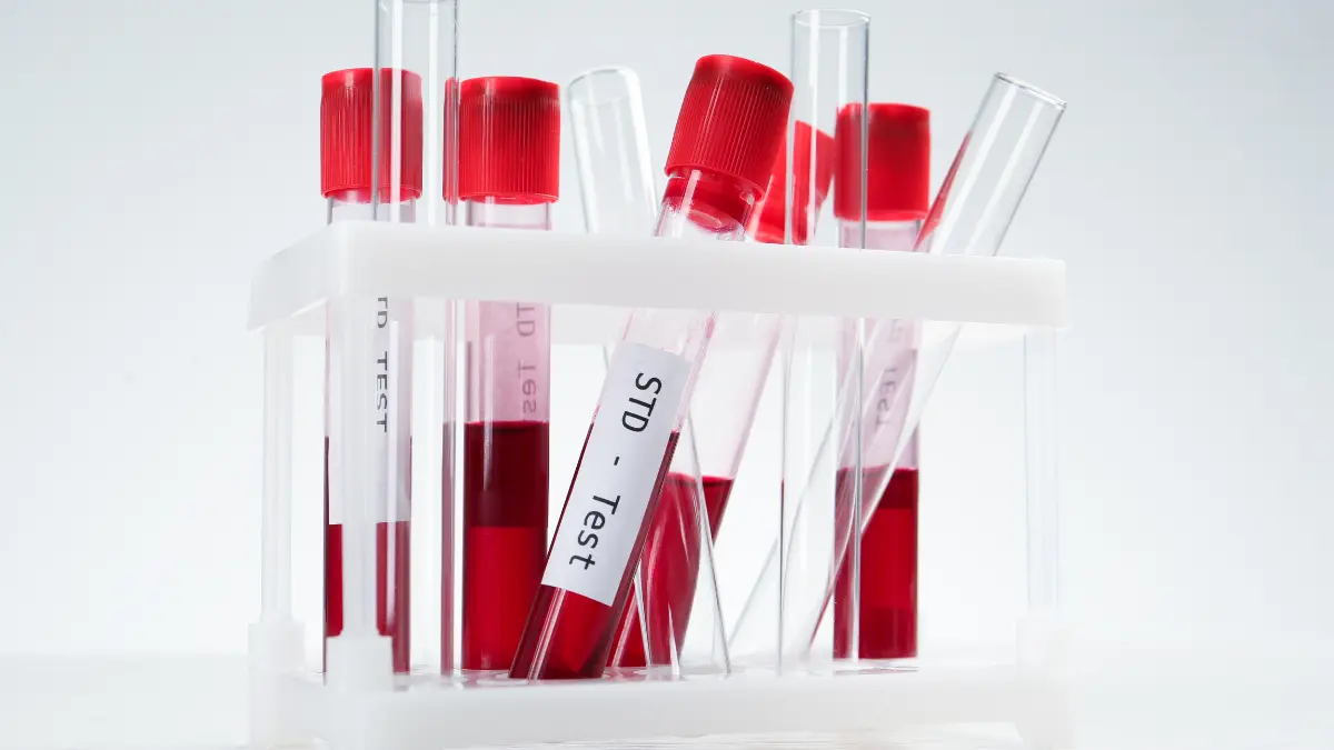 is pcos a sexually transmitted disease