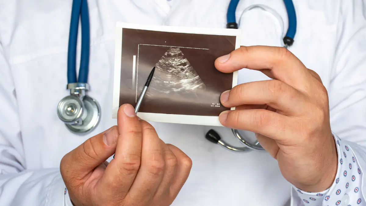 pcos and cysts on ovaries