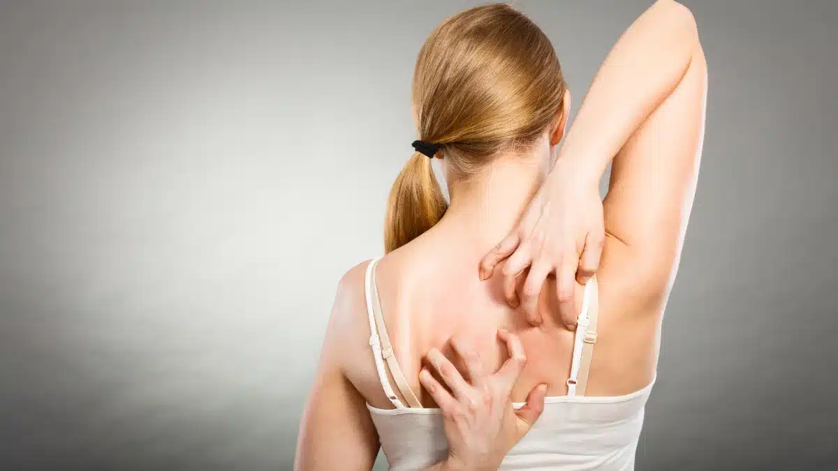 menopause rash