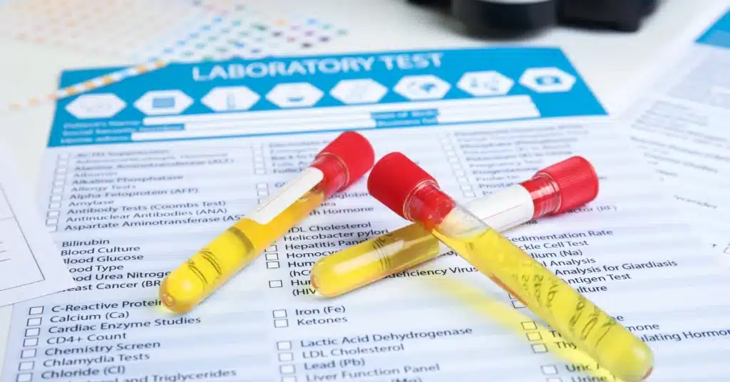 urine test