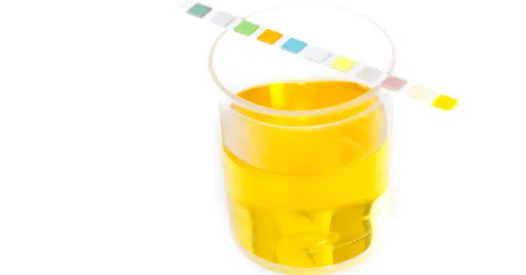 urine test sample