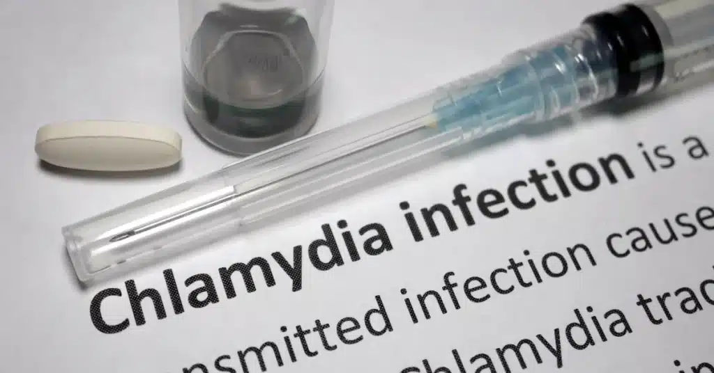 chlamydia infection