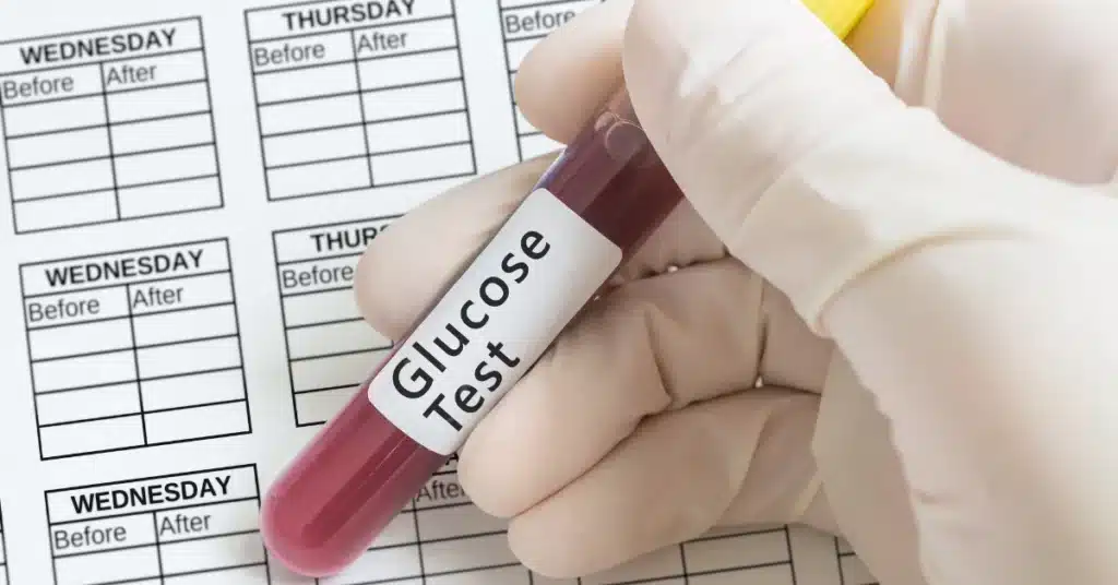 Glucose Test