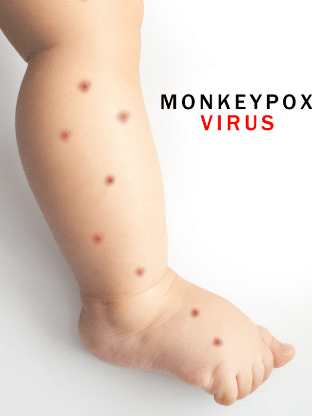 Monkey pox virus