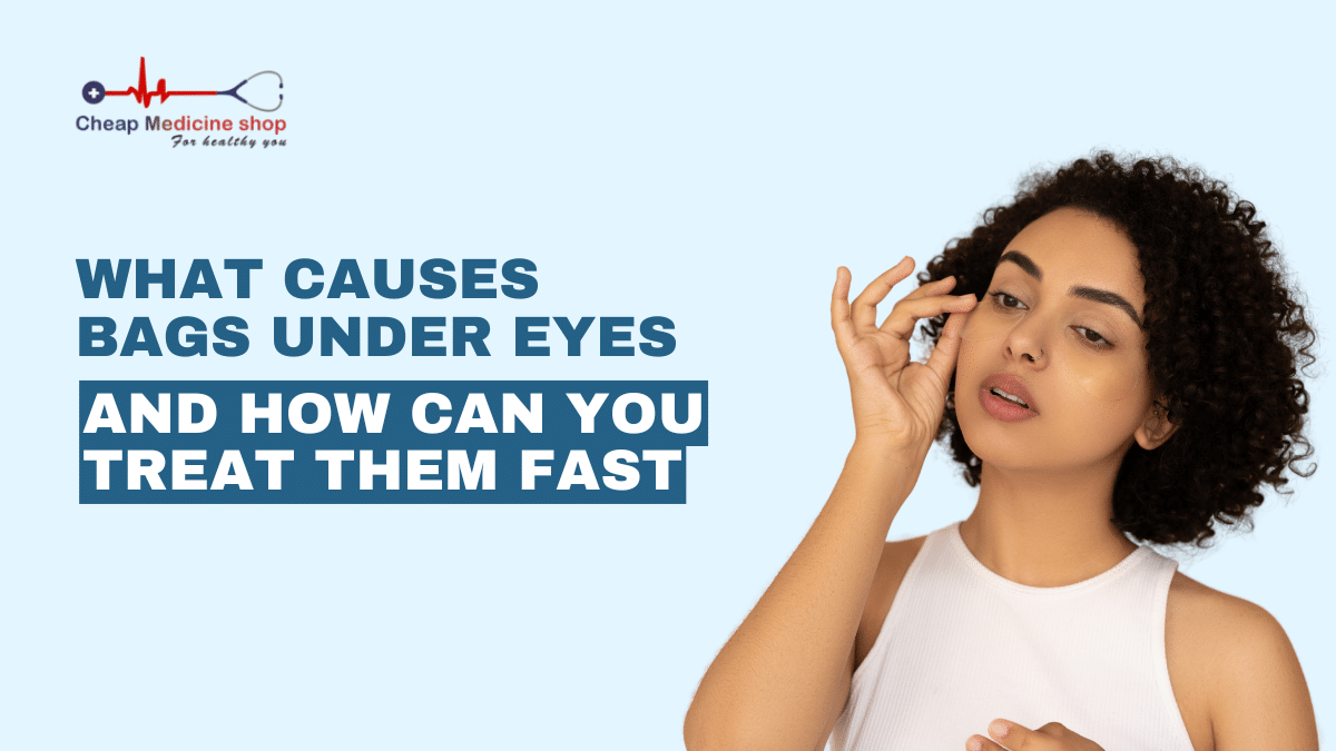 what causes bags under eyes and How Can You Treat Them Fast