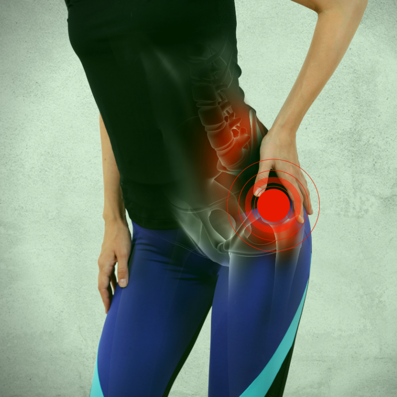 Arthritis Arthritis