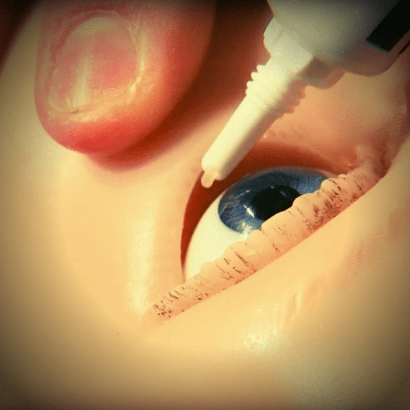 Eye Ointment & Gel